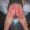 my bloody spanking